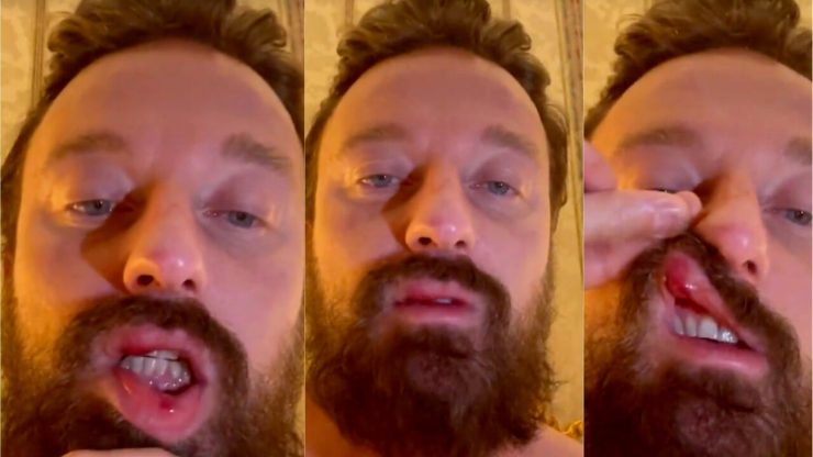 Facchinetti aggredito da Conor McGregor