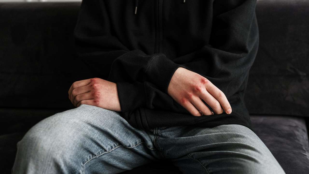 Napoli, coppia di omosessuali presa a insulti e picchiata a sangue: “Li devo fare a pezzi”